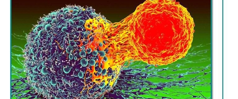 کشف درمان بالقوه کارسینوما سلول سنگفرشی سر و گردن سرطان سلول سنگفرشی سر و گردن (HNSCC) در غشاهای مخاطی دهان ، بینی و گلو ایجاد می شود. این یک بیماری تهاجمی است که با مرگ و میر بالا همراه است و بیش از 90٪ سرطان های سر و گردن را شامل می شود. اکنون دانشمندان برای درمان سرطان پیشرفته سلول سنگفرشی سر و گردن یک روش جدید کشف کرده اند. محققان با استفاده از یک مدل موش ، دریافتند که استفاده از داروی ایمونوتراپی ضد PD1 در ترکیب با PTC209 ، یک مهارکننده که پروتئین BMI1 را هدف قرار می دهد، با موفقیت رشد و گسترش سرطان را متوقف می کند، از بروز مجدد جلوگیری کرده و سلولهای بنیادی سرطانی را از بین می برد.